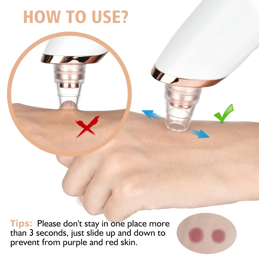 Blemish Remover Kit