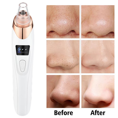 Blemish Remover Kit